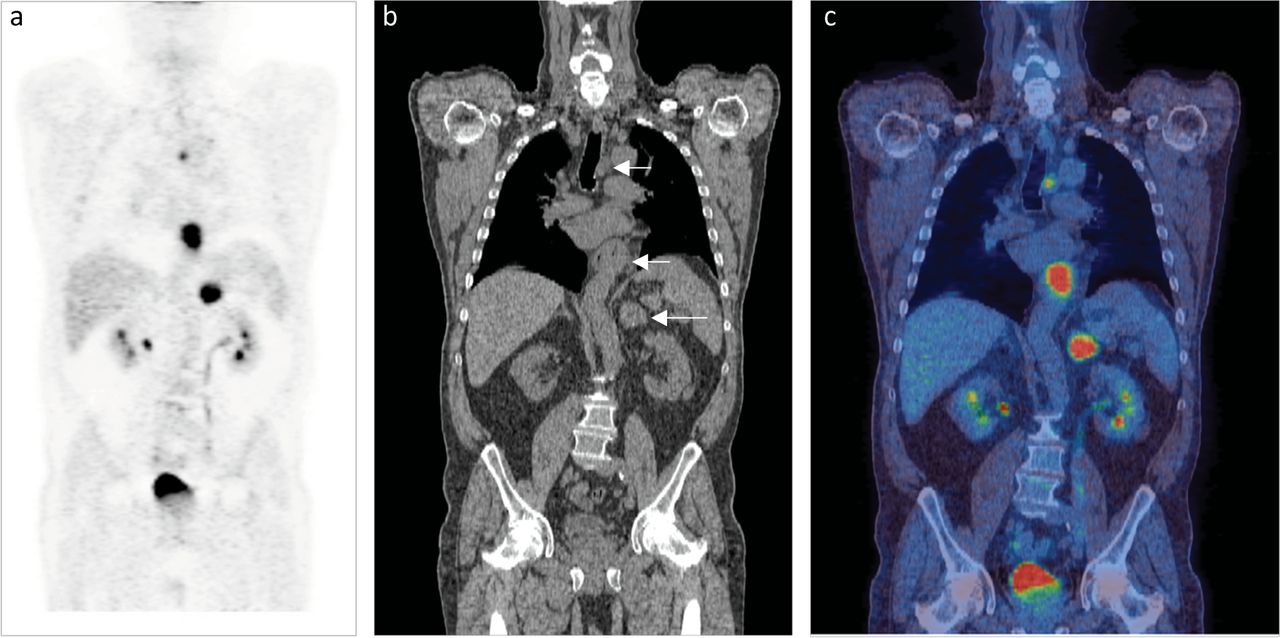 Pet CT In Miami